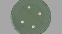 High level antimicrobial resistance of Pseudomonas aeruginosa. The organism is unaffected by the antimicrobial discs used for testing. Image captured using APAS Independence