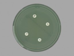 High level antimicrobial resistance of Pseudomonas aeruginosa. The organism is unaffected by the antimicrobial discs used for testing. Image captured using APAS Independence